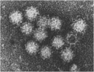 ノロウイルスの顕微鏡写真