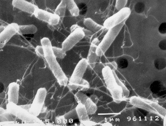 病原性大腸菌O157の電子顕微鏡写真