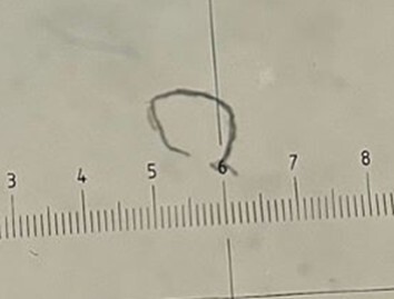 才の瀬橋（瀬野川）で採取されたマイクロプラスチック