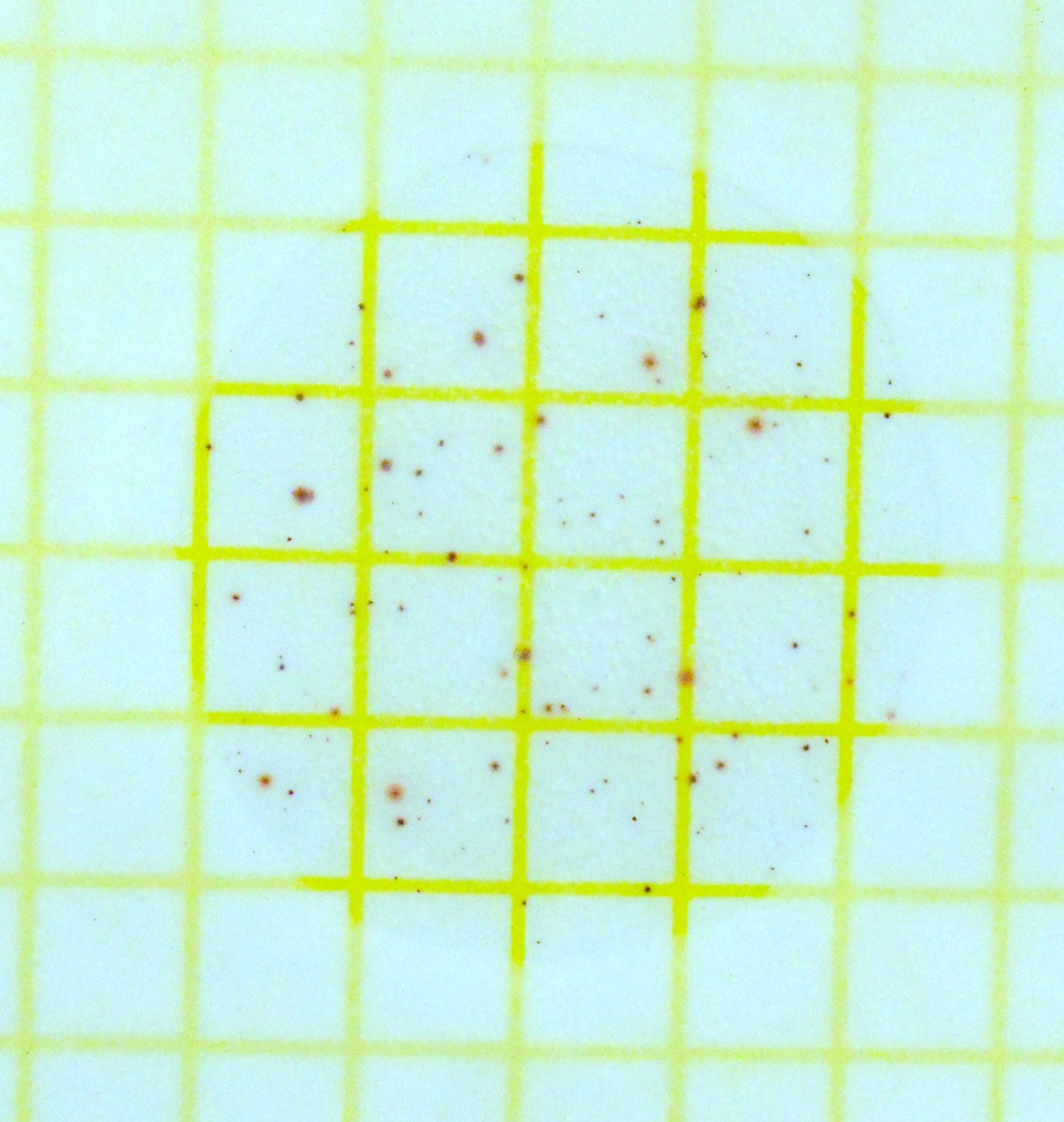 一般生菌数の計測の画像