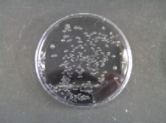GVPC培地上のレジオネラ属菌の画像1
