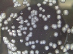 GVPC培地上のレジオネラ属菌集落の画像2