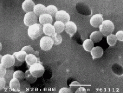 黄色ブドウ球菌の顕微鏡写真