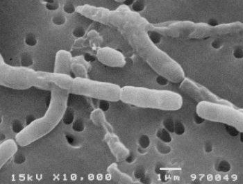 セレウス菌の写真