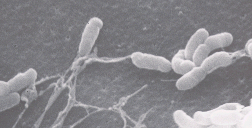 腸炎ビブリオ走査型電子顕微鏡写真