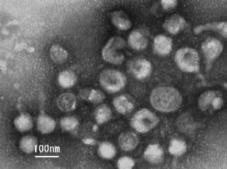 インフルエンザウイルス(AH1N1 2009)の電子顕微鏡写真