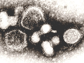 インフルエンザウイルス(Aソ連型)の電子顕微鏡写真