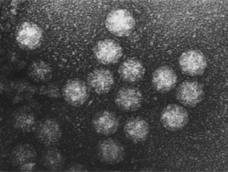 アストロウイルスの電子顕微鏡写真
