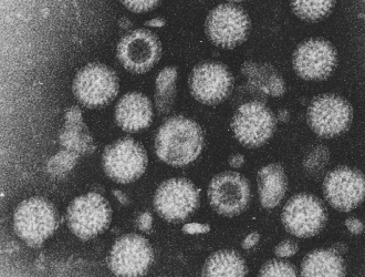 ロタウイルスの電子顕微鏡写真