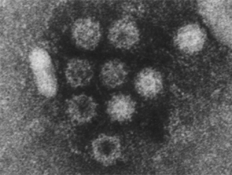 サポウイルスの電子顕微鏡写真