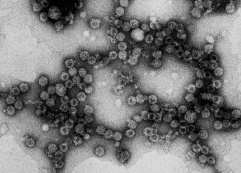 エンテロウイルス(エコーウイルス30型)の電子顕微鏡写真