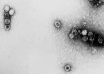 エンテロウイルス(コクサッキーウイルスA16型)の電子顕微鏡写真