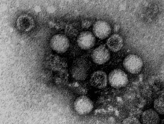 エンテロウイルス(エンテロウイルス71型)の電子顕微鏡写真