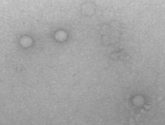 パレコウイルス3型の電子顕微鏡写真