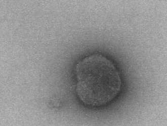 麻疹ウイルスの画像