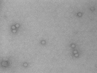 A型肝炎ウイルスの画像