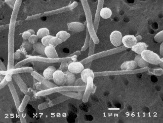 ウエルシュ菌の電子顕微鏡写真