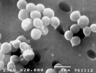 ブドウ球菌の電子顕微鏡写真