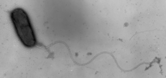 腸炎ビブリオの透過型電子顕微鏡写真