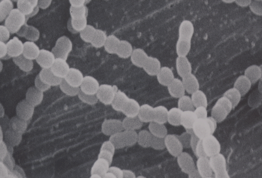 溶血性レンサ球菌の電子顕微鏡写真