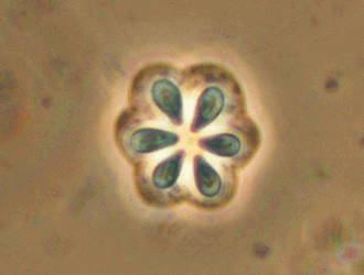 クドアの胞子の光学顕微鏡写真