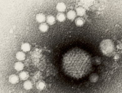 アデノ随伴ウイルスとアデノウイルスの電子顕微鏡写真