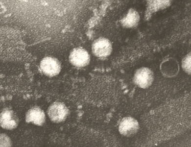 バクテリオファージの電子顕微鏡写真
