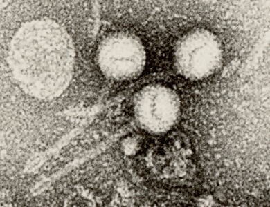 バクテリオファージの電子顕微鏡写真