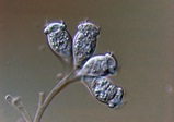 微生物エピスティリスの画像
