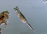 微生物ヒルガタワムシの画像
